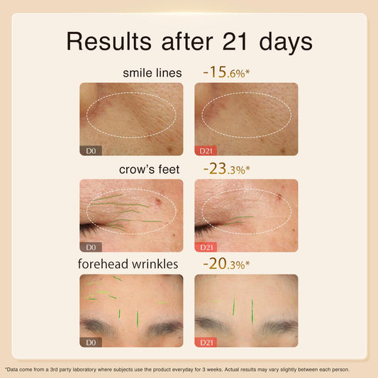 Facial Mask for Dry Skin & Fine Line, Hydrating Cream Face Mask by Peptide, Collagen & Stem Cell for Skin Firming, Face Masks for Women from Japan, Paraben Free, AG Ultimate Cream Mask, 3.8 Oz